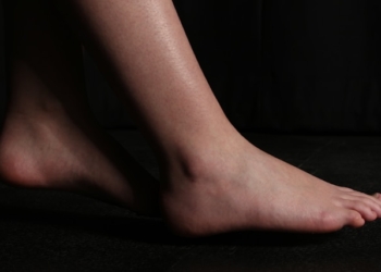 Jak domowe sposoby na skręconą kostkę przyspieszają gojenie?